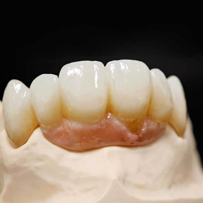 lucja-skowronska-protetyka