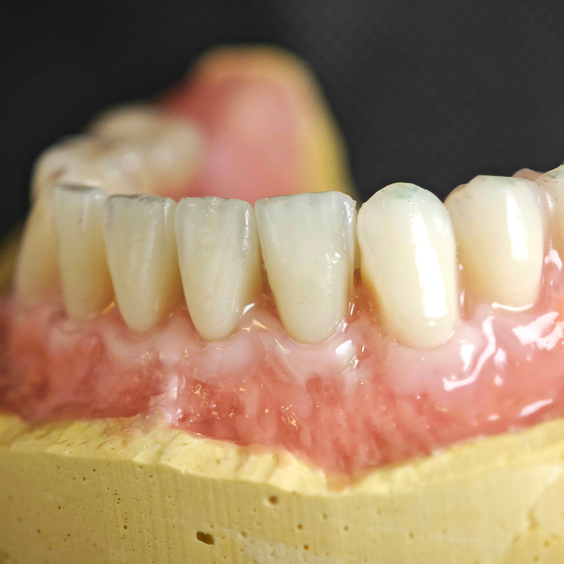 lucja-skowronska-protetyka_2