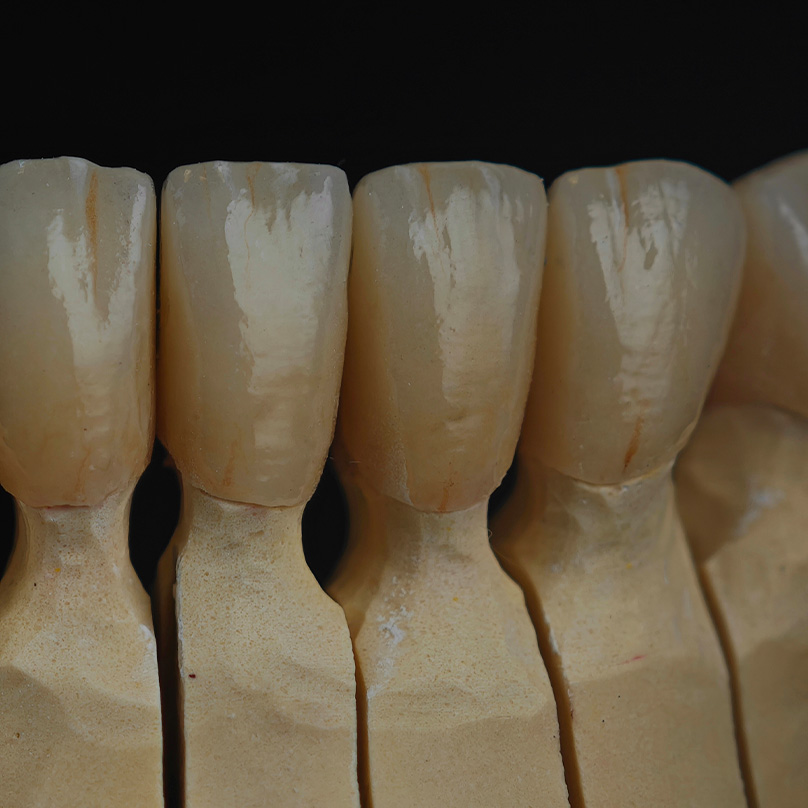 lucja-skowronska-protetyka_3